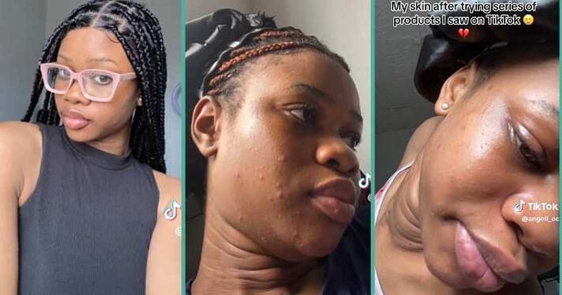 Lady laments over rough skin after joining skincare trend