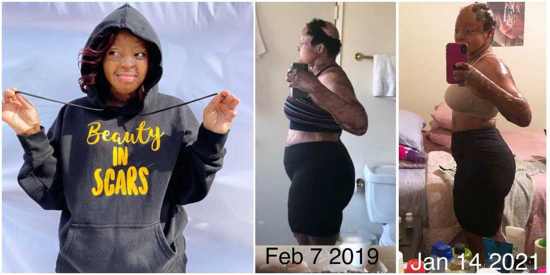 Plane crash survivor Kechi Okwuchi shares body transformation photos Plane crash survivor Kechi Okwuchi shares body transformation photos