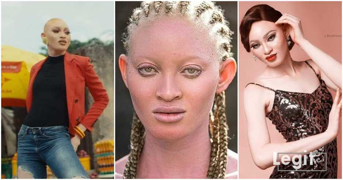 Vivian Adenijo, 24-year-old model, albino, Osun state, Nigeria, People Living with Albinism (PWA) Vivian Adenijo, 24-year-old model, albino, Osun state, Nigeria, People Living with Albinism (PWA)