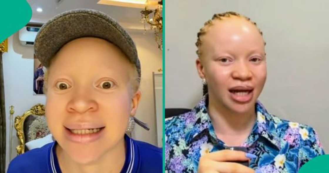 Albino lady shares her personal experience with her eyesight.