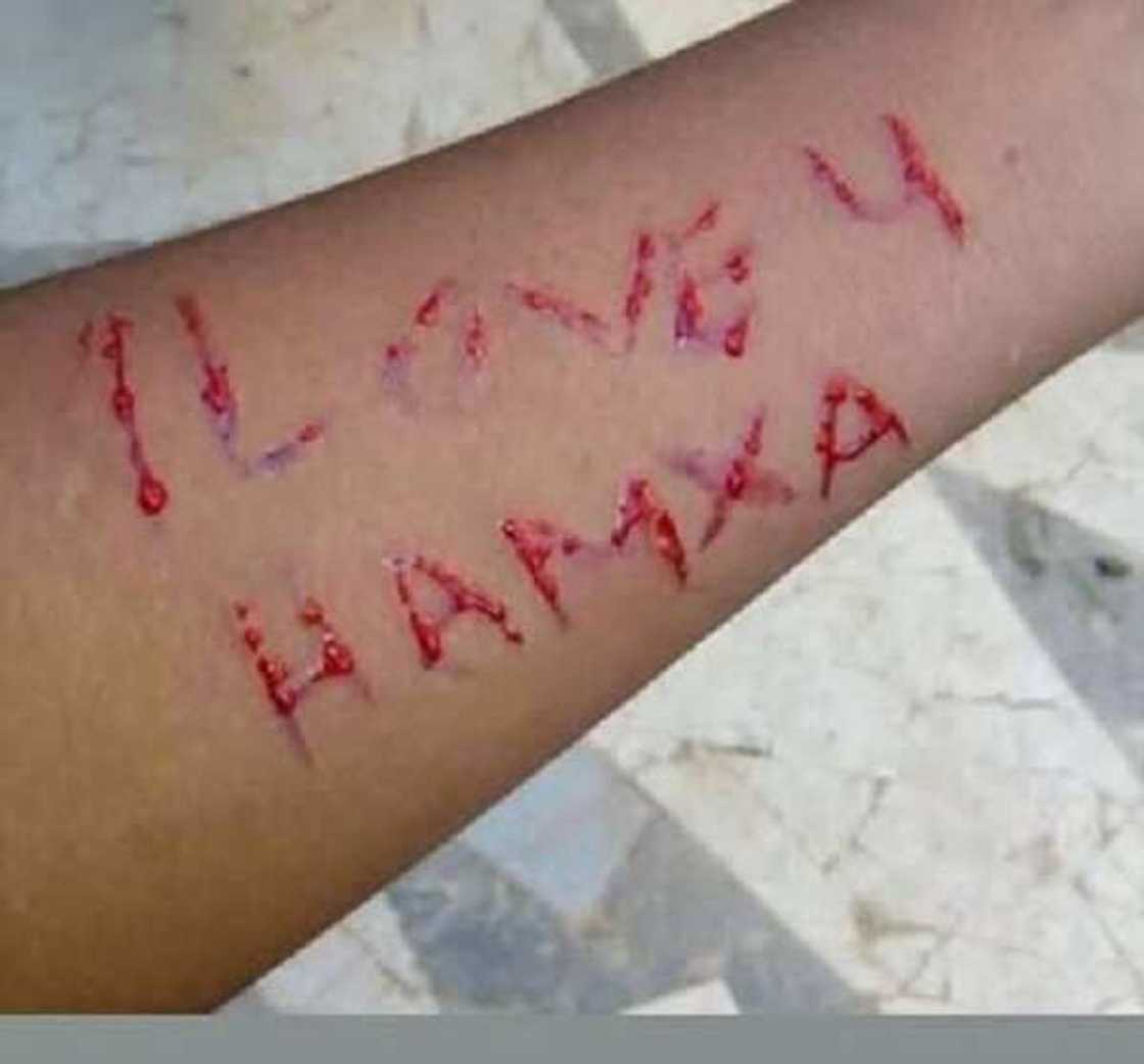 Yarinyar da ya tsaga jikinta da sunan Masoyi ta kawo kararsa Facebook Yarinyar da ya tsaga jikinta da sunan Masoyi ta kawo kararsa Facebook