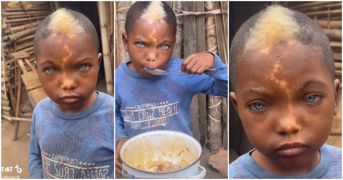 boy with natural blue eyes, lightening mark on face & white frontal hairs, boy with light eyes goes viral boy with natural blue eyes, lightening mark on face & white frontal hairs, boy with light eyes goes viral