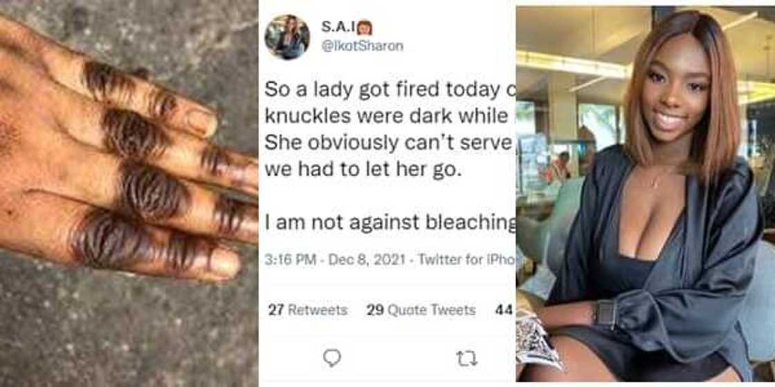 Nigerian Restaurant fires Waitress for Bleaching her Skin, Having Dark Knuckles Nigerian Restaurant fires Waitress for Bleaching her Skin, Having Dark Knuckles