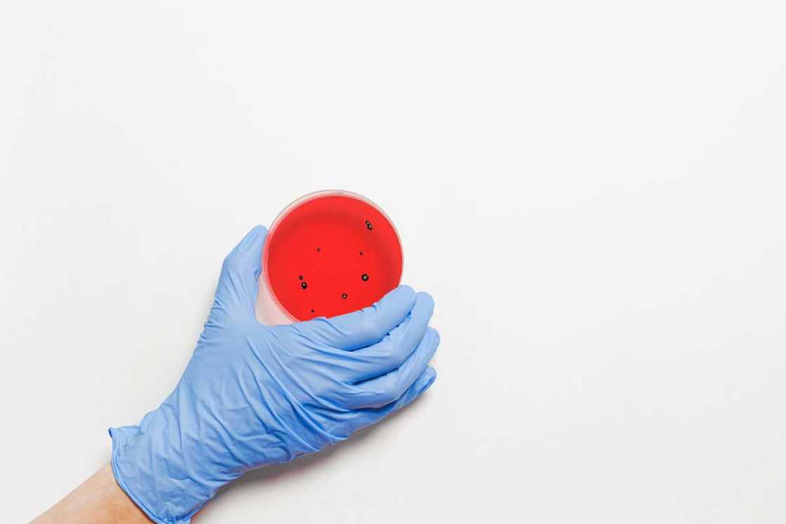 A person holding a petri dish A person holding a petri dish