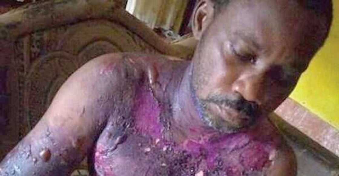 Kan sabani, Uwargida ta yiwa mijinta wanka da tafasasshen ruwan zafi Kan sabani, Uwargida ta yiwa mijinta wanka da tafasasshen ruwan zafi