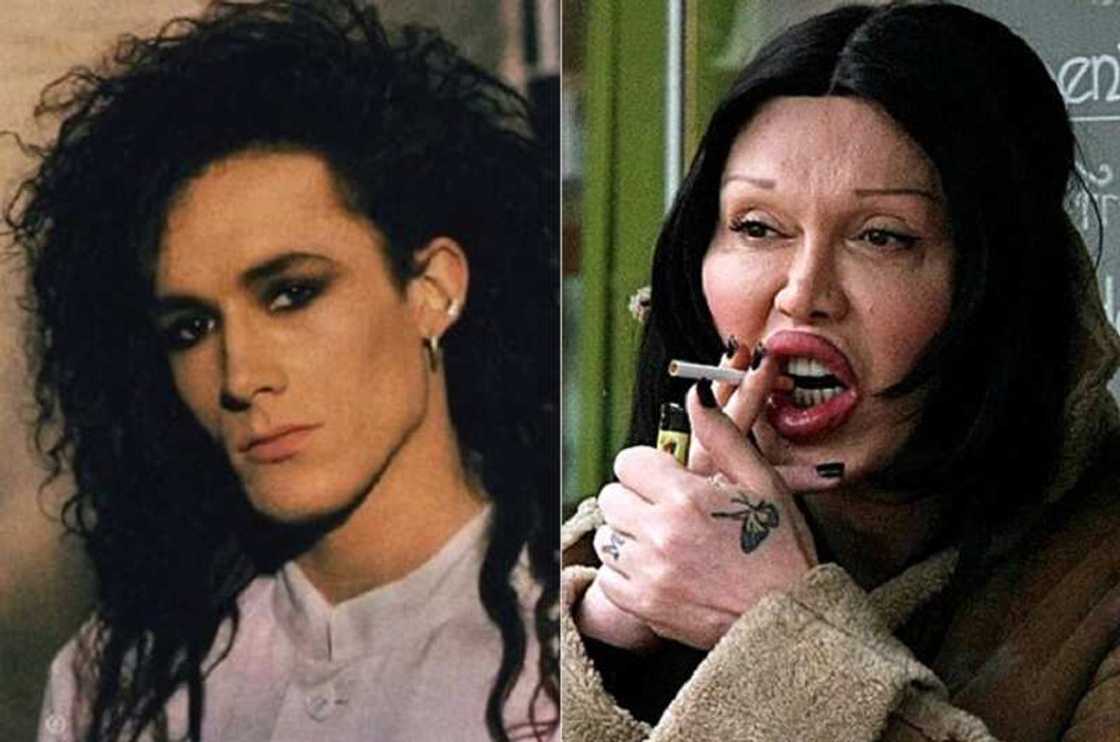 Pete Burns before and after Pete Burns before and after