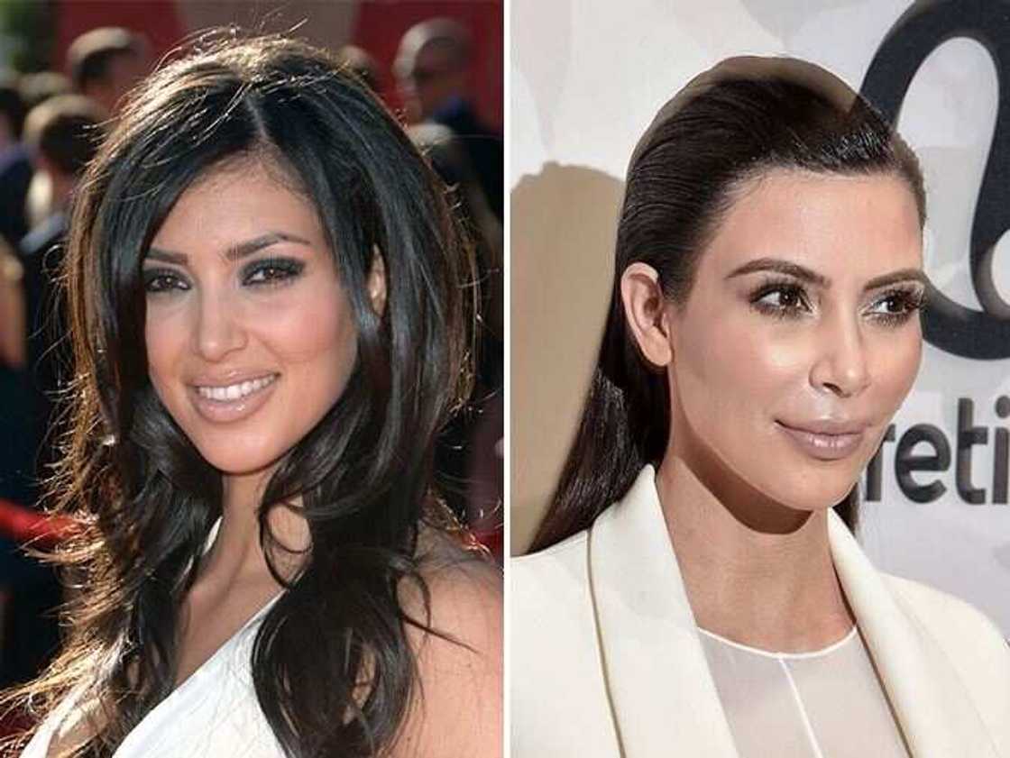Kim Kardashian before and after Kim Kardashian before and after