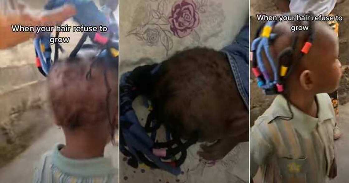 Little girl with scanty hair, hair refused to grow, hairstyle Little girl with scanty hair, hair refused to grow, hairstyle