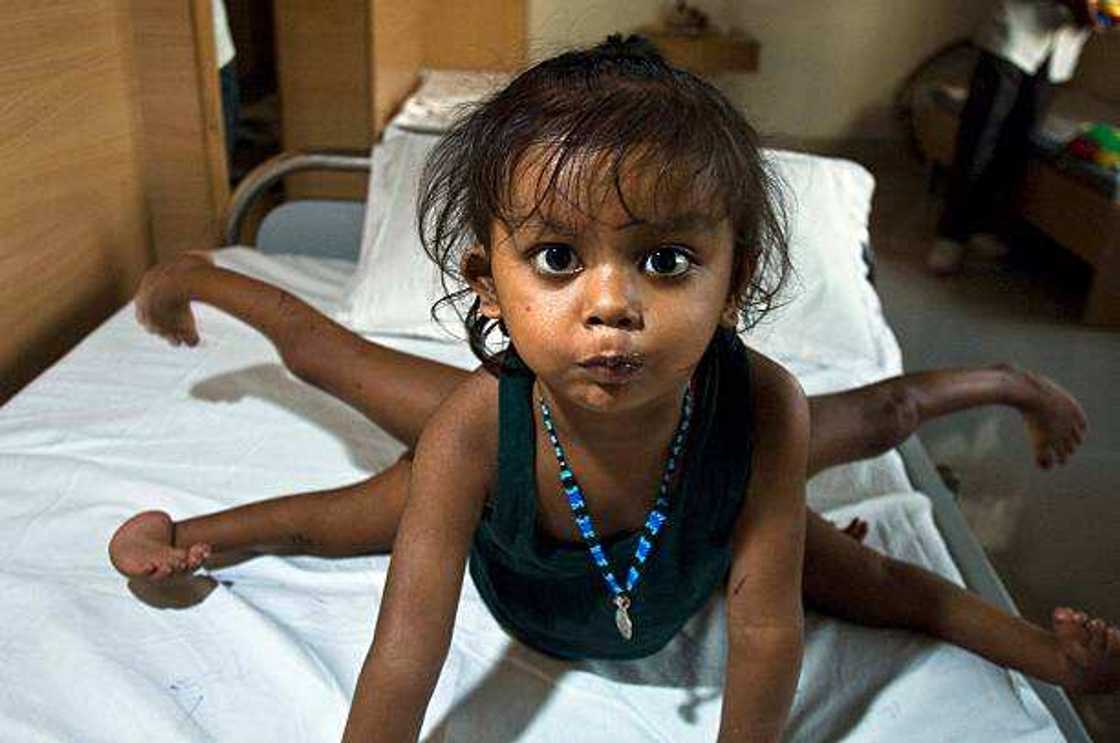 Ikon Allah: Wata yarinya da aka haifa da kafafu da hannaye hudu ta cika shekaru 2, hotuna Ikon Allah: Wata yarinya da aka haifa da kafafu da hannaye hudu ta cika shekaru 2, hotuna