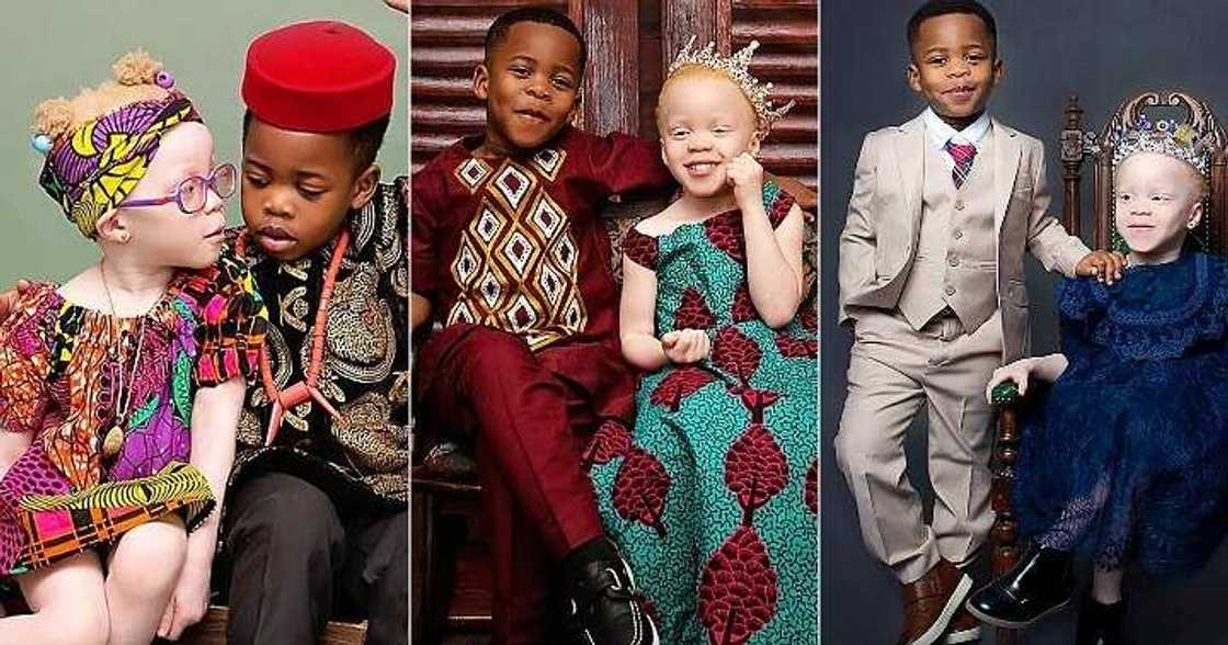 Cute black boy and albino twin sister Cute black boy and albino twin sister
