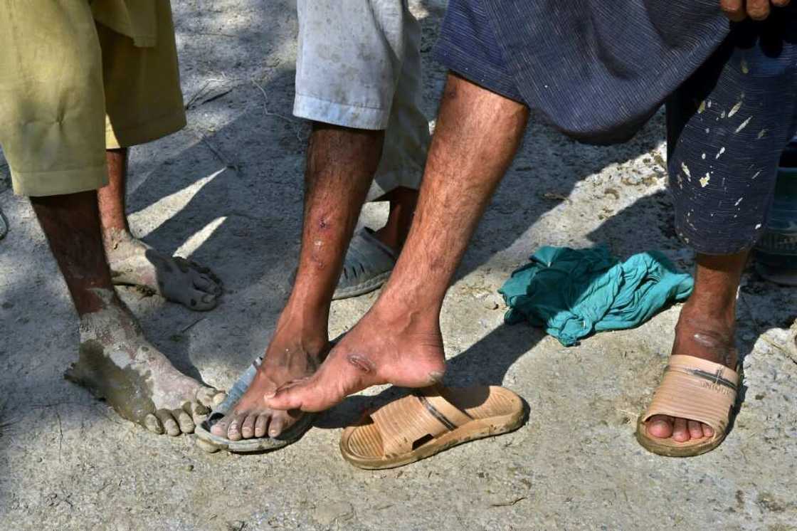 Many people have got cuts and sores from wading through flooded fields