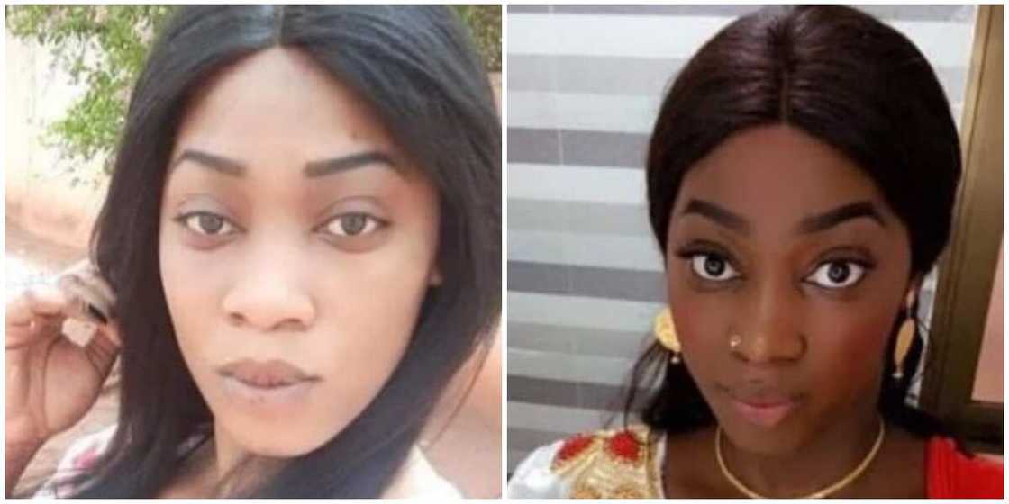 Photos of a lady who stopped bleaching.