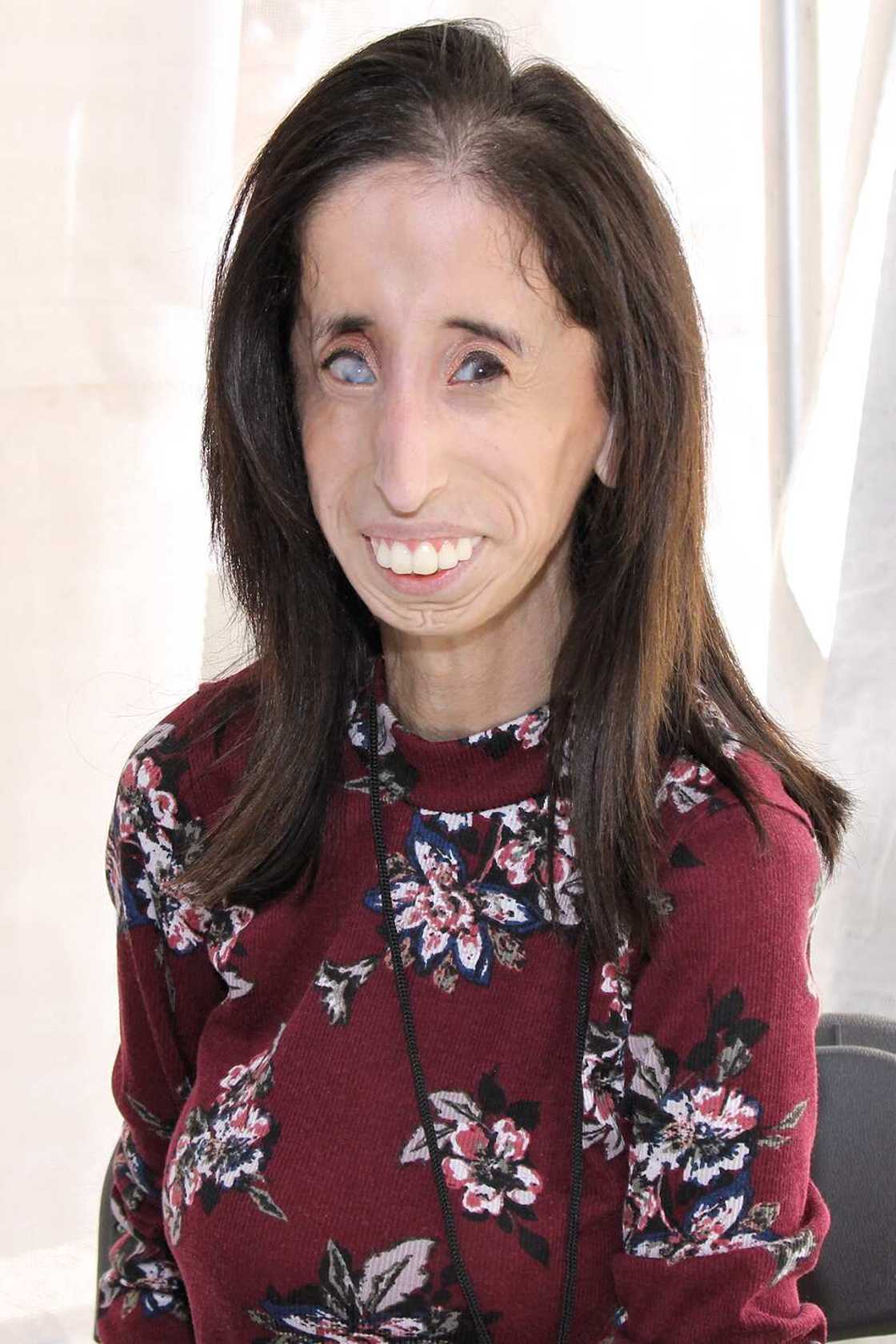 Lizzie Velasquez