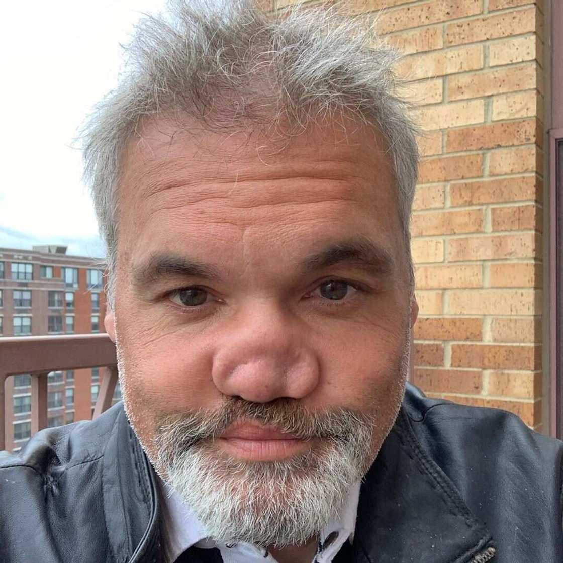 Artie Lange nose Artie Lange nose