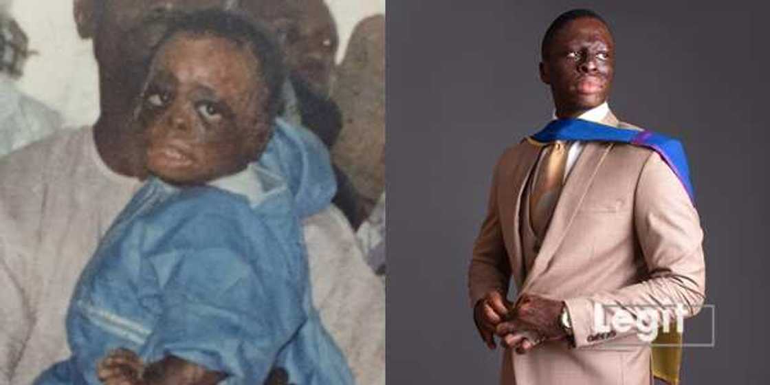 Great Nkor survived a fire incident Great Nkor survived a fire incident