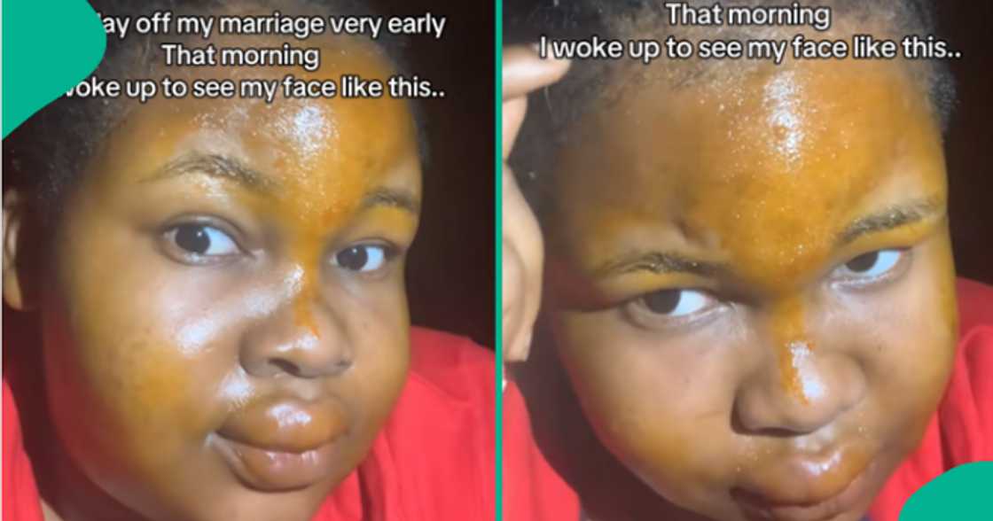 Bride's face and hands begin swelling on her traditional wedding eve.