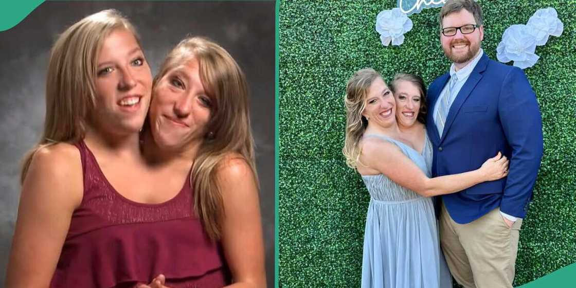 Abby and Brittany Hensel. Abby and Brittany Hensel.