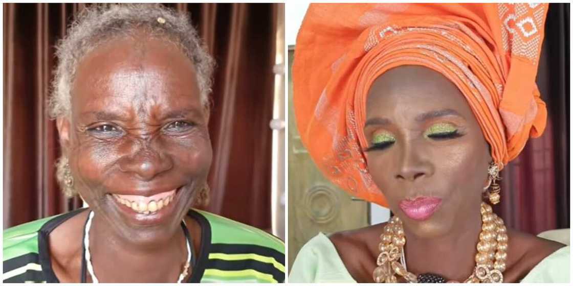 Photos of the lady before and after. Photos of the lady before and after.