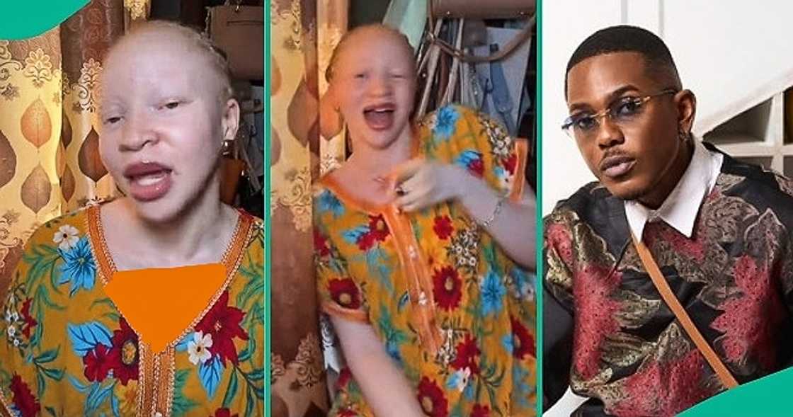 Albino lady shares why she can't crush on Timini Egbuson