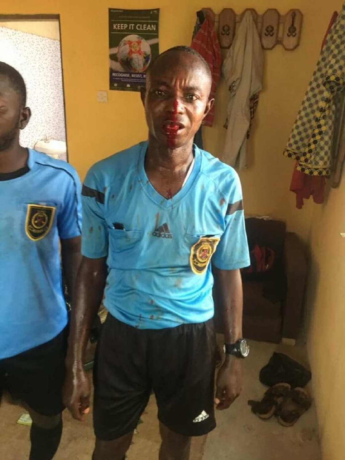 Hotunan Alƙalan Wasa Da Fusatattun Ƴan Kallo Suka Yi Wa Duka Ciki Har Da Wanda Ya Rasa Haƙoransa Hotunan Alƙalan Wasa Da Fusatattun Ƴan Kallo Suka Yi Wa Duka Ciki Har Da Wanda Ya Rasa Haƙoransa