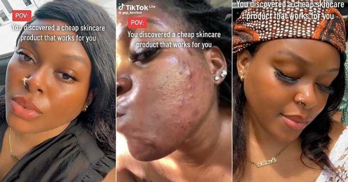 Lady's facial transformation stuns many