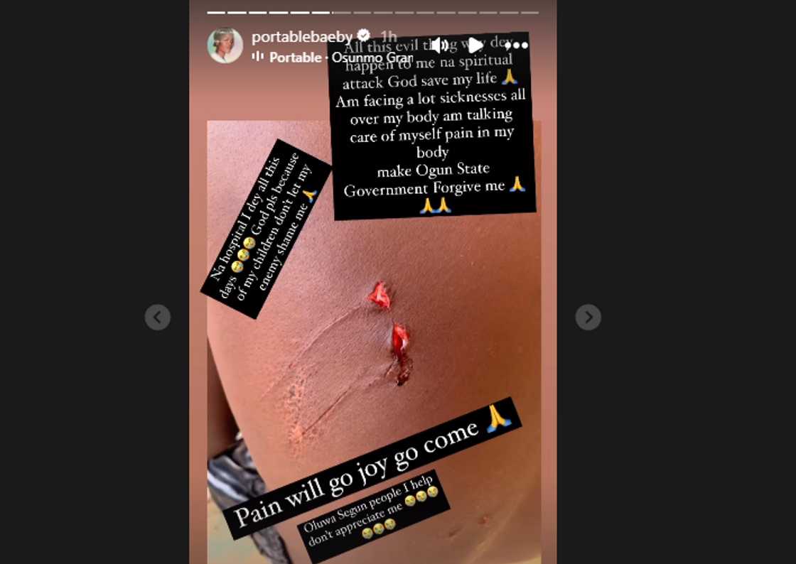 Portable shares photo of his injury after claim of being under spiritual attack. Portable shares photo of his injury after claim of being under spiritual attack.