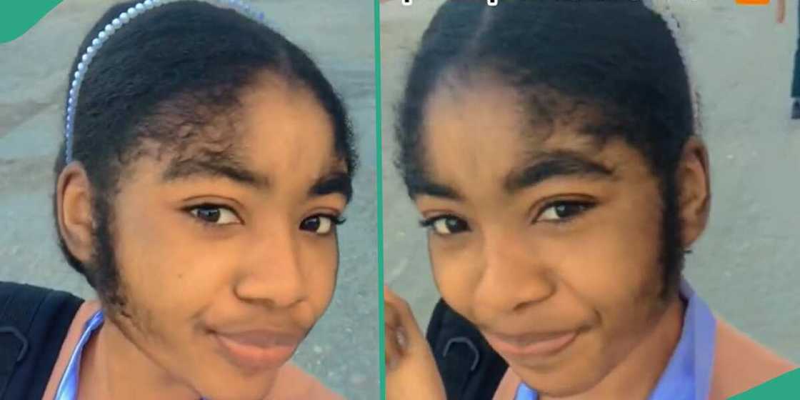 Lady with a hairy face shows it off on social media. Lady with a hairy face shows it off on social media.