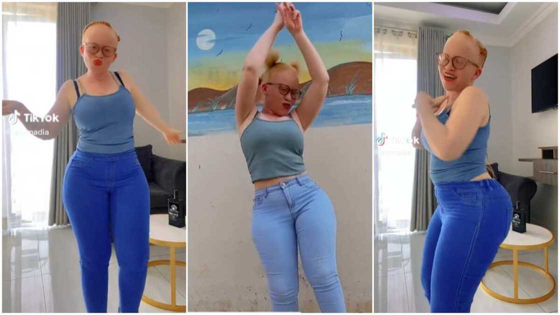 Albino girl with skin colour/Lady danced in video. Albino girl with skin colour/Lady danced in video.