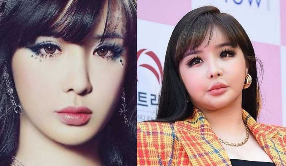 Park Bom before and after Park Bom before and after