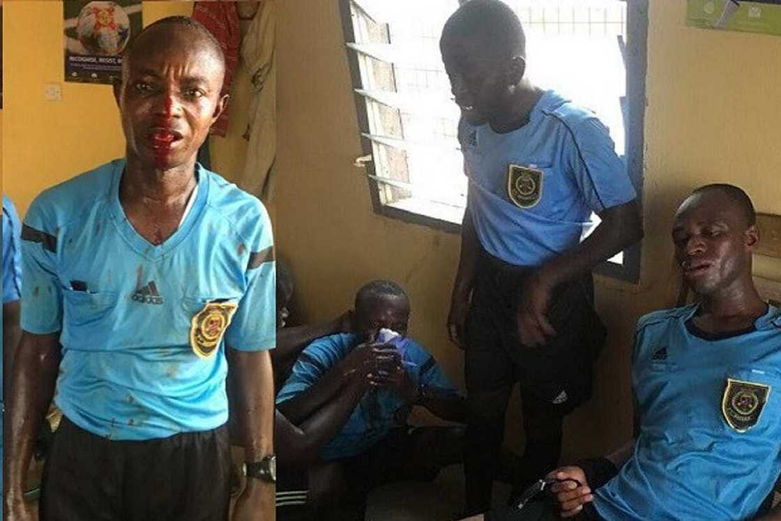 Hotunan Alƙalan Wasa Da Fusatattun Ƴan Kallo Suka Yi Wa Duka Ciki Har Da Wanda Ya Rasa Haƙoransa Hotunan Alƙalan Wasa Da Fusatattun Ƴan Kallo Suka Yi Wa Duka Ciki Har Da Wanda Ya Rasa Haƙoransa