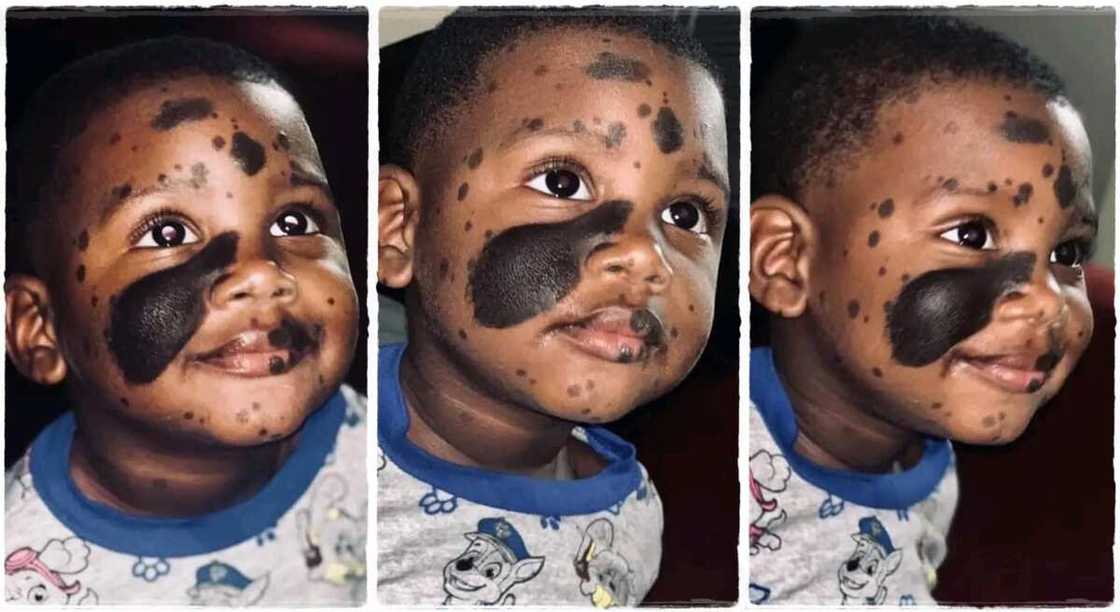 Photos of a boy with black patches on his face. Photos of a boy with black patches on his face.