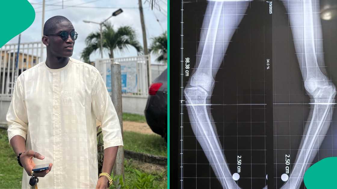Man declares his desire to have BMW hours after people raised N22m for his corrective leg surgery Man declares his desire to have BMW hours after people raised N22m for his corrective leg surgery