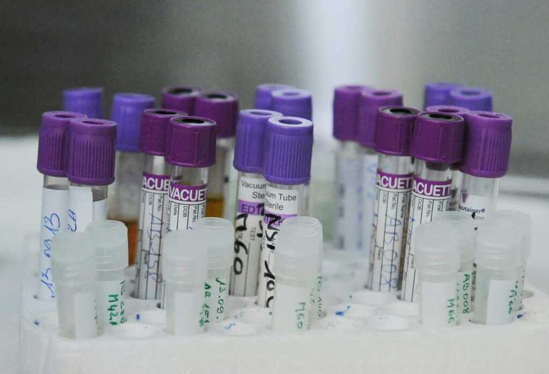 Blood samples taken in 2013 as part of a Unitaid-funded project to better survey people living with HIV in Abidjan, Ivory Coast Blood samples taken in 2013 as part of a Unitaid-funded project to better survey people living with HIV in Abidjan, Ivory Coast