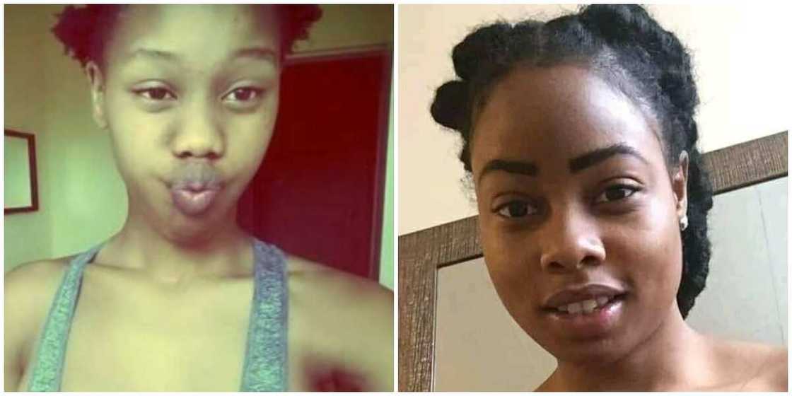Young lady survives breast cancer, shares her topless look, photo sparks 'explosive reactions on social media Young lady survives breast cancer, shares her topless look, photo sparks 'explosive reactions on social media