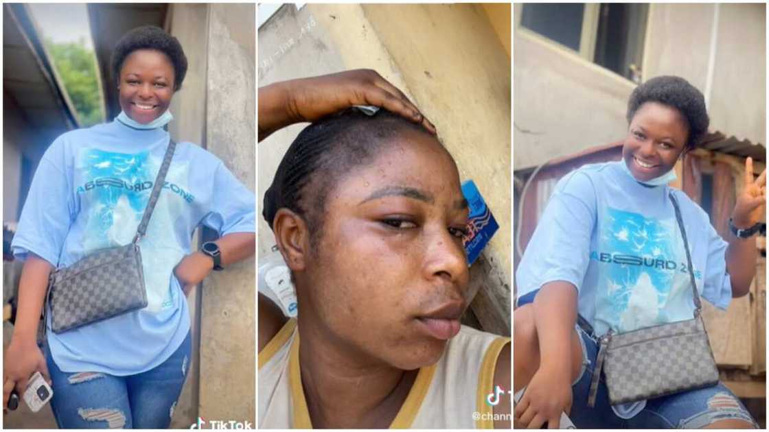 Bleaching skin/natural black skin. Bleaching skin/natural black skin.