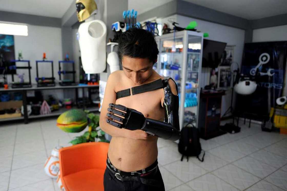Marco Antonio Nina, 26, who lost his left arm at the age of 14 in a work accident, tests his bionic arm prosthesis that Roly Mamani made for him in his 'Robotics Creators' workshop in Achocalla, Bolivia, on January 8, 2024 Marco Antonio Nina, 26, who lost his left arm at the age of 14 in a work accident, tests his bionic arm prosthesis that Roly Mamani made for him in his 'Robotics Creators' workshop in Achocalla, Bolivia, on January 8, 2024
