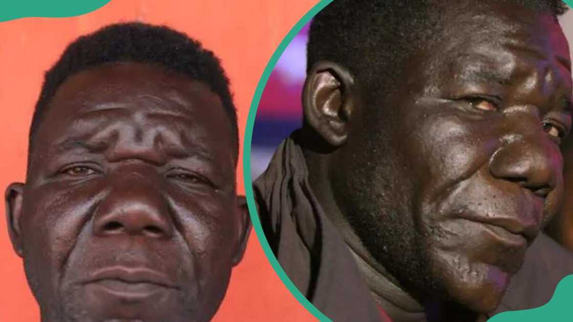 Williams Masvinu is recognised for his large nose and facial features. Williams Masvinu is recognised for his large nose and facial features.