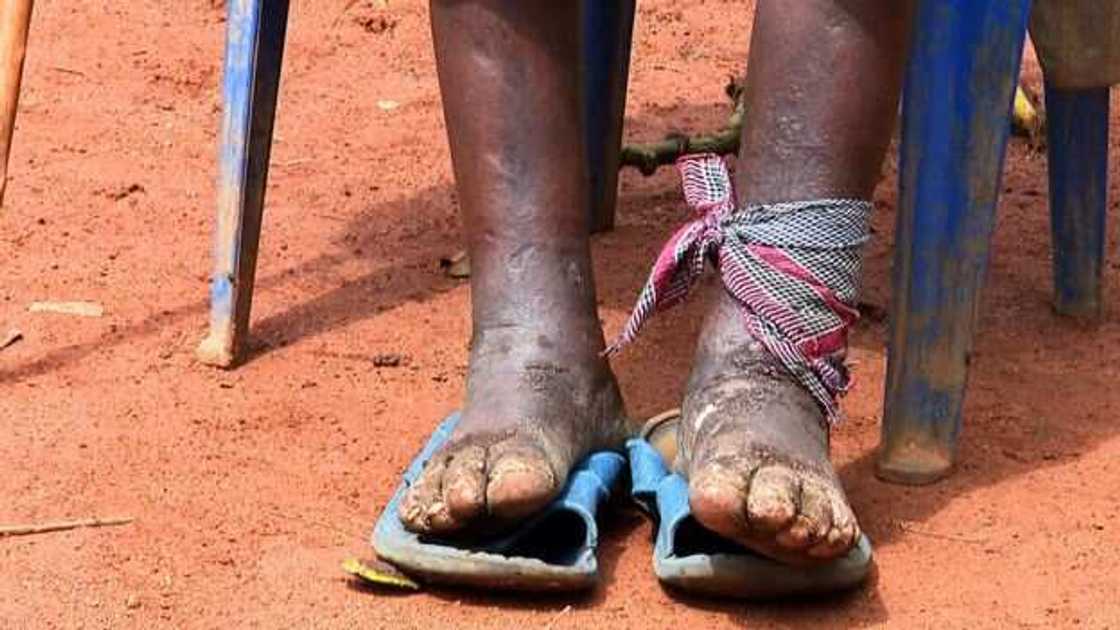 3 family members die in village devastated by elephantiasis 3 family members die in village devastated by elephantiasis