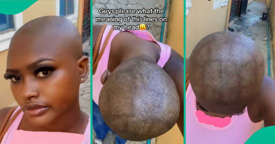Nigerian lady sees lines on her head after shaving. Nigerian lady sees lines on her head after shaving.