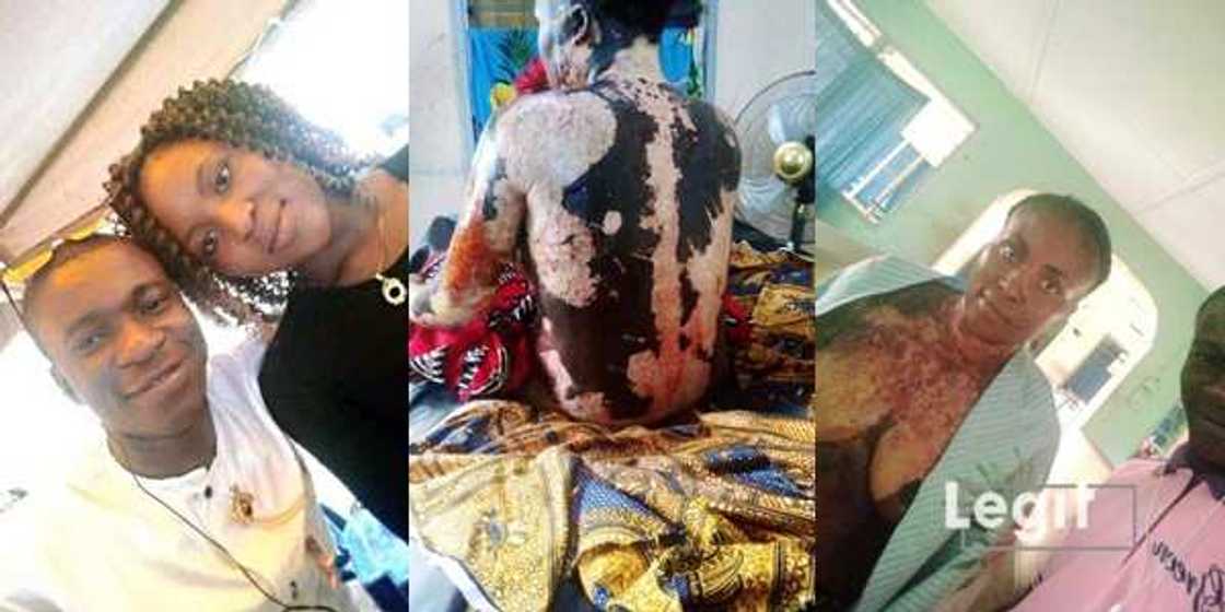 Kenneth Ogagbo: Help 1-year-old boy who lost his mum to fire accident to beat burns Kenneth Ogagbo: Help 1-year-old boy who lost his mum to fire accident to beat burns