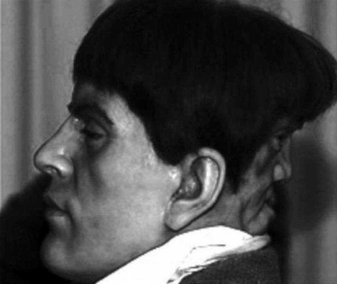 Edward Mordrake Edward Mordrake