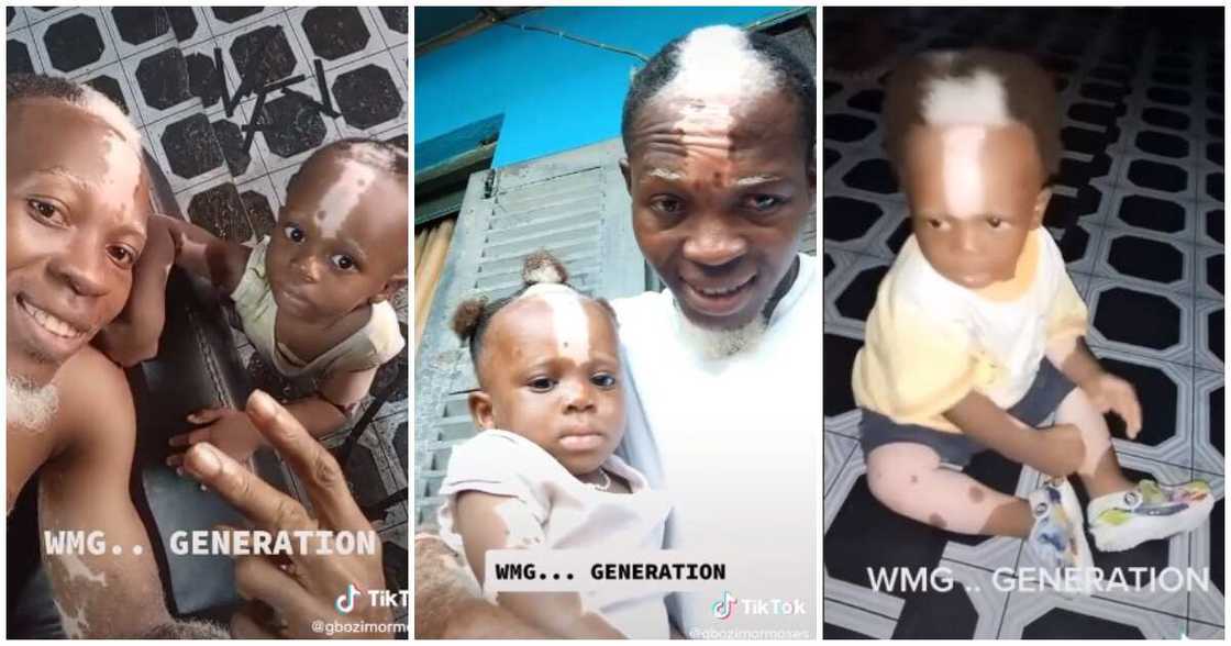 Nigerian kid born with white frontal hairs, kid and dad birn with white frontal hairs, video of Nigerina kid born with white frontal hairs and unique birth marks Nigerian kid born with white frontal hairs, kid and dad birn with white frontal hairs, video of Nigerina kid born with white frontal hairs and unique birth marks