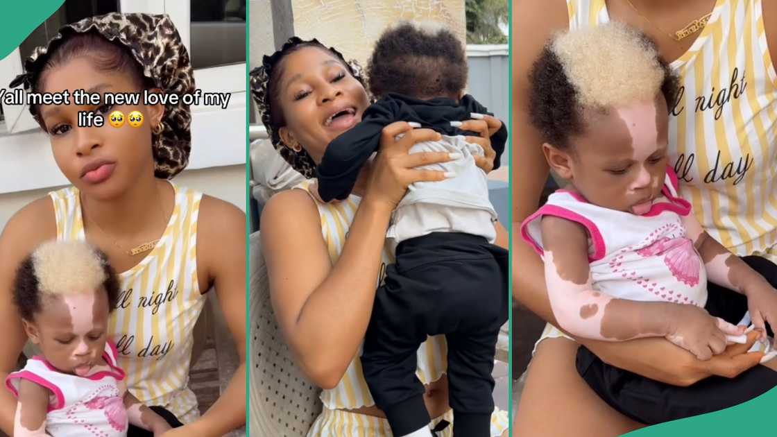 Lady shows off baby with unique birthmark. Lady shows off baby with unique birthmark.