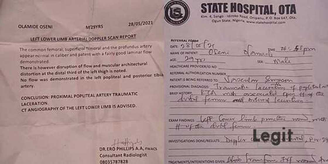 Security man whose leg was amputated after accident seeks help to pay hospital bill Security man whose leg was amputated after accident seeks help to pay hospital bill