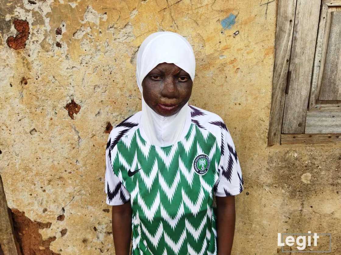 I cannot breathe - Rokeebat needs N2m to save her life from deadly nose infection I cannot breathe - Rokeebat needs N2m to save her life from deadly nose infection