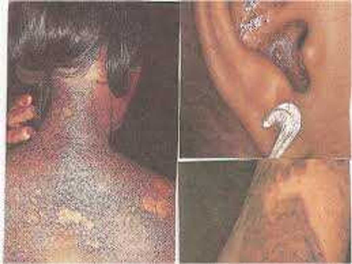 The plague of skin bleaching in Africa The plague of skin bleaching in Africa