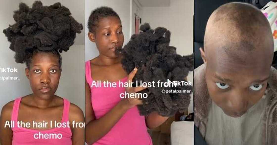 Lady loses her hair to chemotherapy.