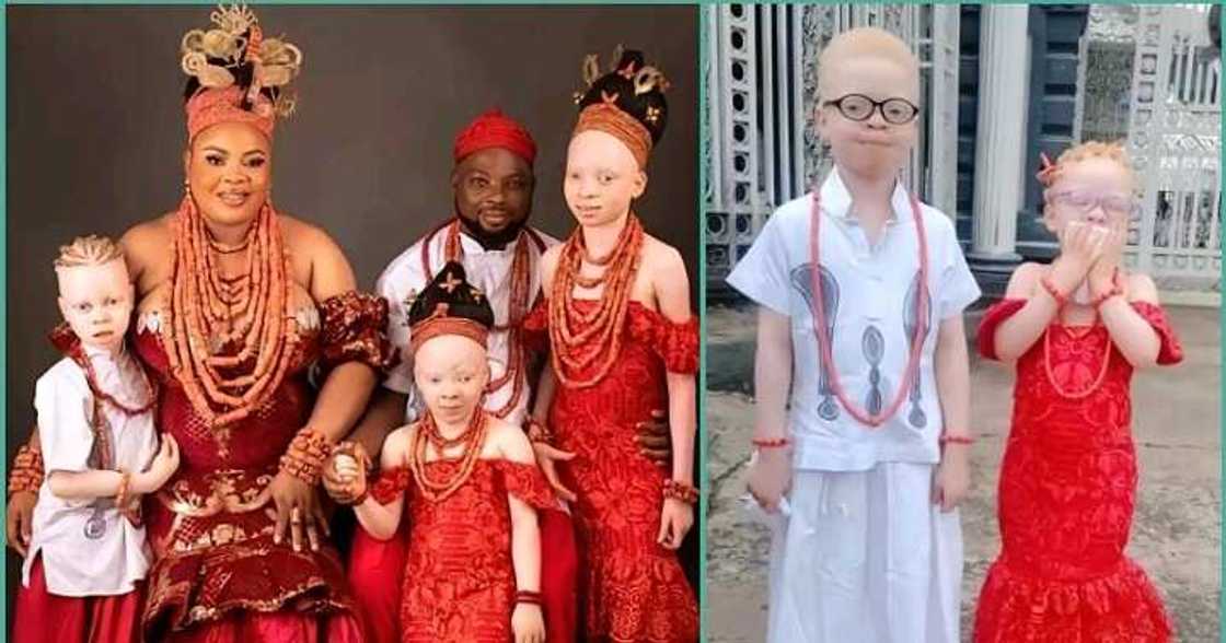 Couple with three 'albino' children goes viral on TikTok