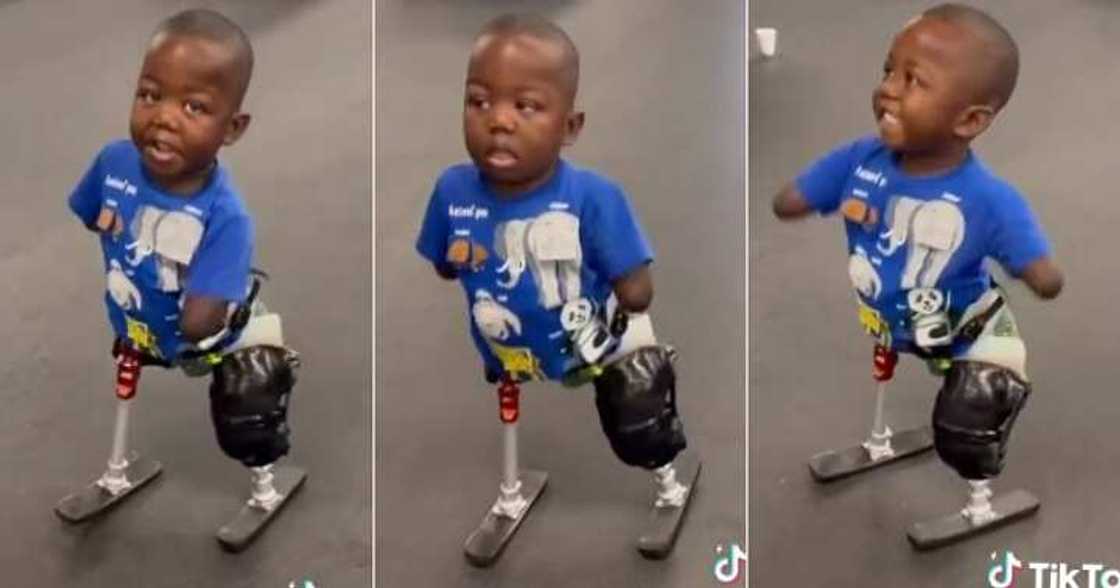 Little boy walks gently with prosthetics Little boy walks gently with prosthetics