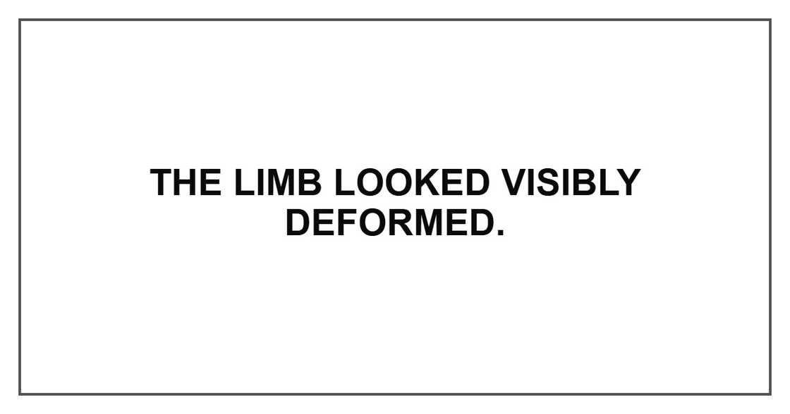 The limb looked visibly deformed.